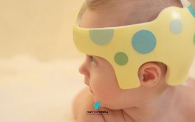 Plagiocefalia en bebés: que es, como se cura, causas y tratamiento de fisioterapia