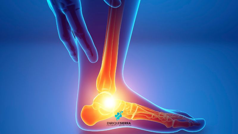 Zapatos para la fascitis plantar