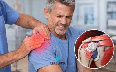 ¿Cuánto tarda en curarse una calcificación en el hombro?